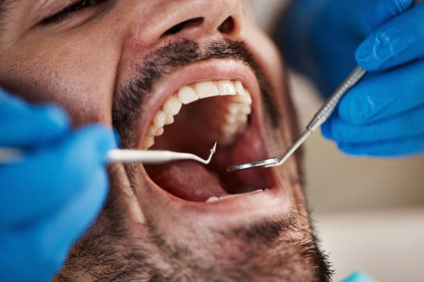 Best Urgent Tooth Repair  in Banks, OR